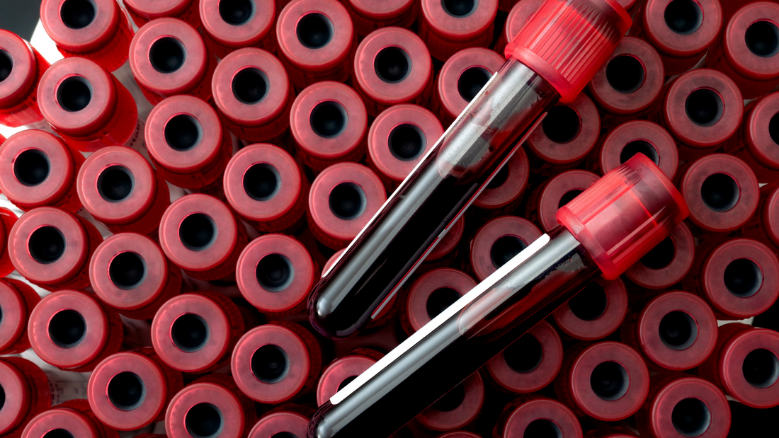 Nuvictus Advance Blood tests